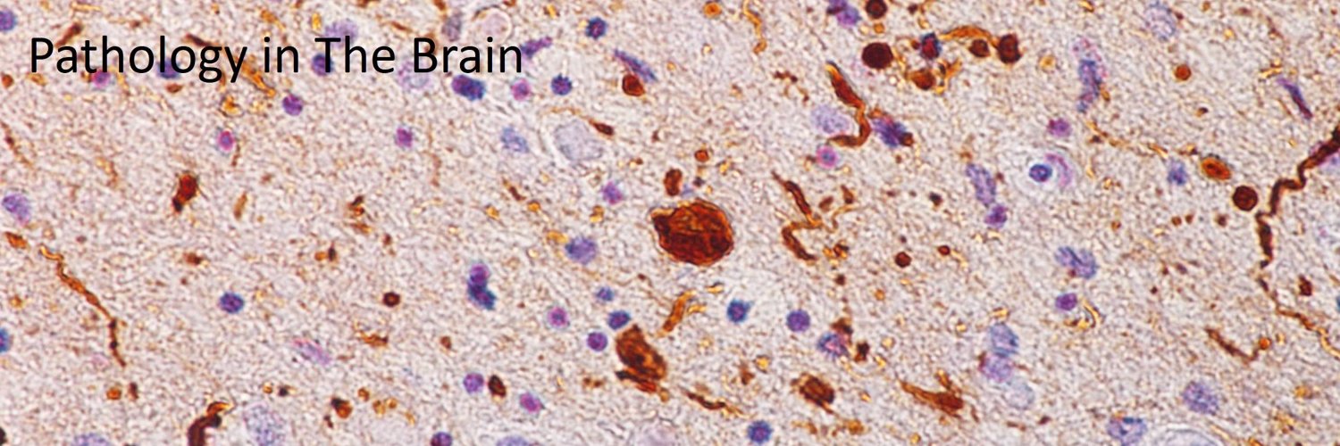 pathology in disease brain image image