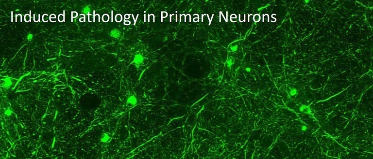 Primary neuron interferon transfer