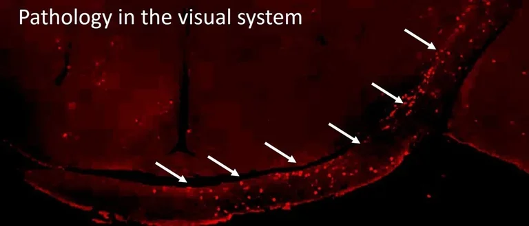 Red illustration of visual system.