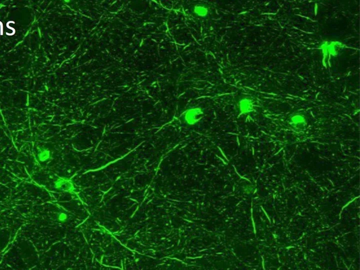 Primary neuron interferon transfer